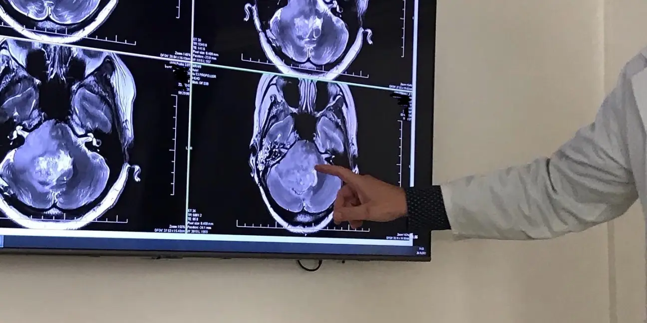 Brain Czech z.s. - obrázek 1