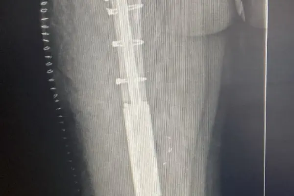 Monika Kamešová - příběh Hero - obrázek 2