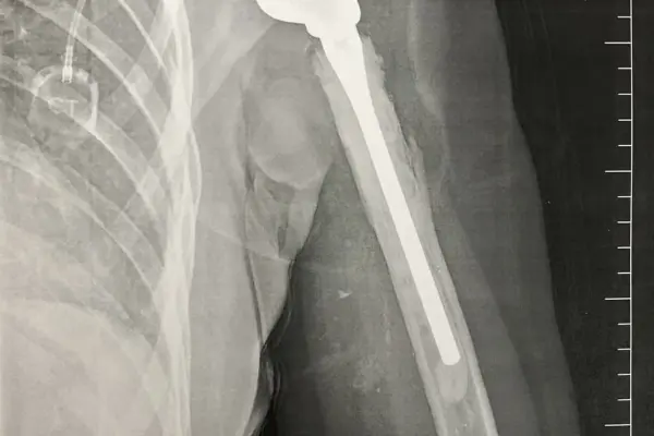 Monika Kamešová - příběh Hero - obrázek 4