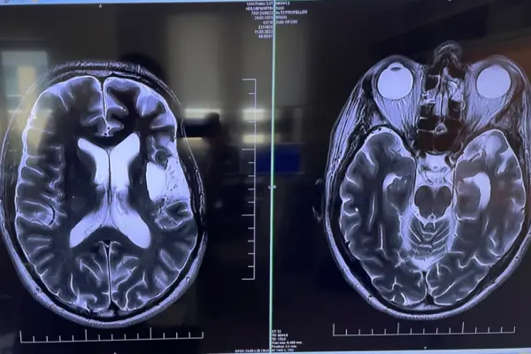 Martin Holub - příběh Hero - obrázek 2